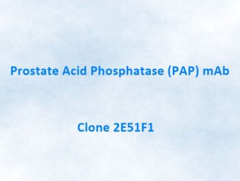 Prostate Acid Phosphatase (PAP) Monoclonal Antibody, 2E51F1