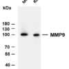 MMP9 Rabbit Monoclonal Antibody