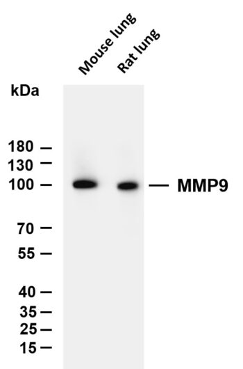 MMP9 Rabbit Monoclonal Antibody