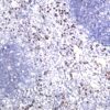 MMP9 Rabbit Monoclonal Antibody - Image 2