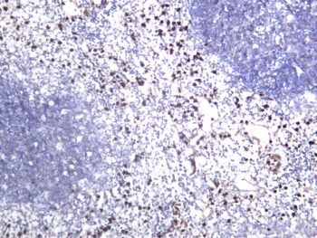 MMP9 Rabbit Monoclonal Antibody - Image 2