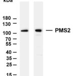 PMS2 Rabbit Monoclonal Antibody