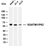 SQSTM1/p62 Rabbit Monoclonal Antibody