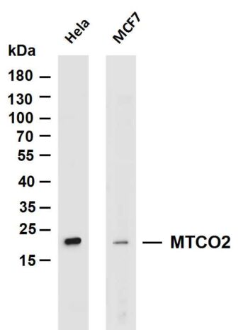 MTCO2 Rabbit Monoclonal Antibody