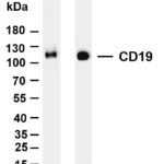 CD19 Rabbit Monoclonal Antibody