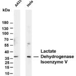 Lactate Dehydrogenase Isoenzyme V Rabbit Monoclonal Antibody
