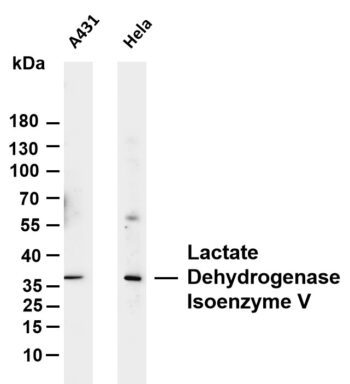 Lactate Dehydrogenase Isoenzyme V Rabbit Monoclonal Antibody