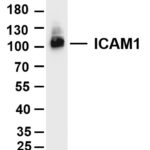 ICAM1 Rabbit Monoclonal Antibody