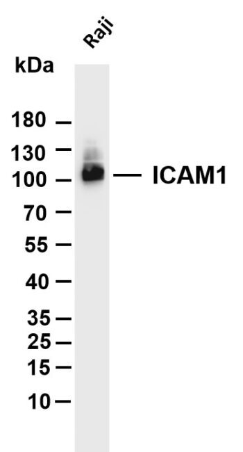 ICAM1 Rabbit Monoclonal Antibody