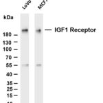IGF1 Receptor Rabbit Monoclonal Antibody