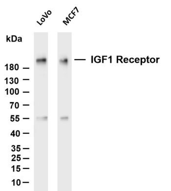IGF1 Receptor Rabbit Monoclonal Antibody