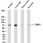 TBR1 Rabbit Monoclonal Antibody
