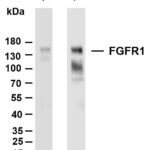 FGFR1 Rabbit Monoclonal Antibody