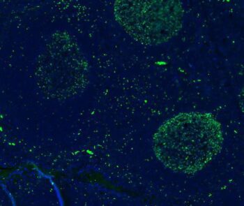 Ki67 Rabbit Monoclonal Antibody - Image 2