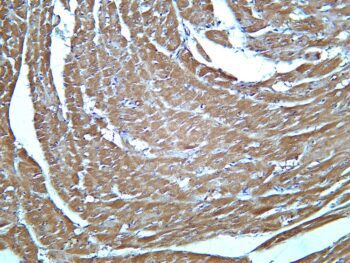 Lactate Dehydrogenase Isoenzyme V Rabbit Monoclonal Antibody - Image 2