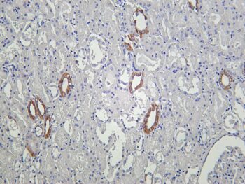 ICAM1 Rabbit Monoclonal Antibody - Image 2