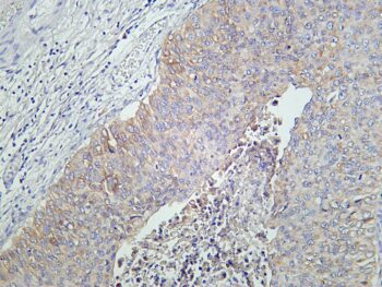 IGF1 Receptor Rabbit Monoclonal Antibody - Image 2