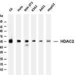 HDAC2 Rabbit Monoclonal Antibody