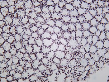 HDAC2 Rabbit Monoclonal Antibody - Image 2