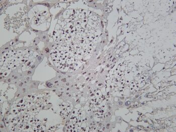 MiTF Rabbit Monoclonal Antibody - Image 2