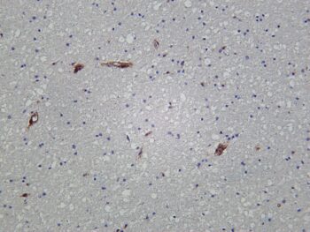 IFITM3 Rabbit Monoclonal Antibody - Image 2