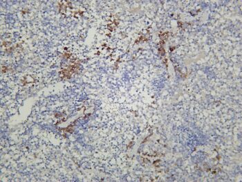 IL18 Rabbit Monoclonal Antibody - Image 2