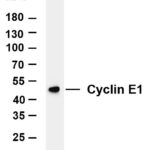 Cyclin E1 Rabbit Monoclonal Antibody