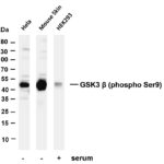 GSK3 β (Phospho-Ser9) Rabbit Monoclonal Antibody