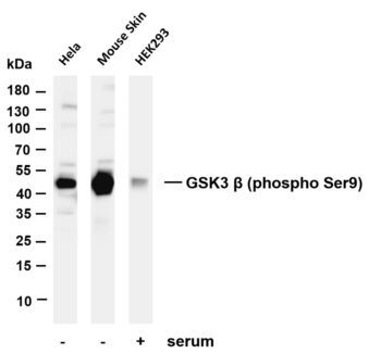 GSK3 β (Phospho-Ser9) Rabbit Monoclonal Antibody