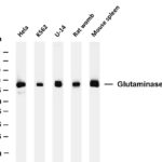 Glutaminase C Rabbit Monoclonal Antibody
