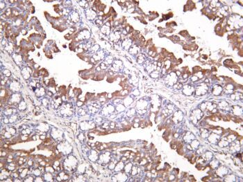 Glutaminase C Rabbit Monoclonal Antibody - Image 2