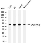 UQCRC2 Rabbit Monoclonal Antibody