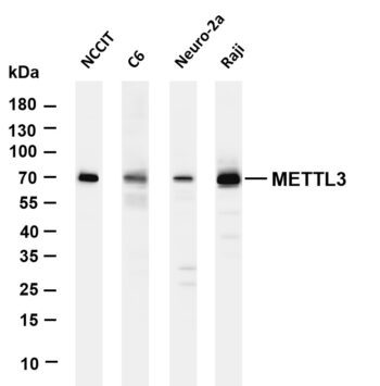 METTL3 Rabbit Monoclonal Antibody