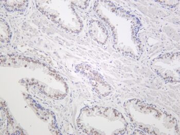 METTL3 Rabbit Monoclonal Antibody - Image 2