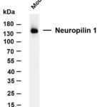 Neuropilin 1 Rabbit Monoclonal Antibody