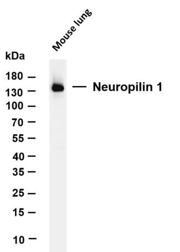 Neuropilin 1 Rabbit Monoclonal Antibody