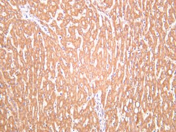 Neuropilin 1 Rabbit Monoclonal Antibody - Image 2