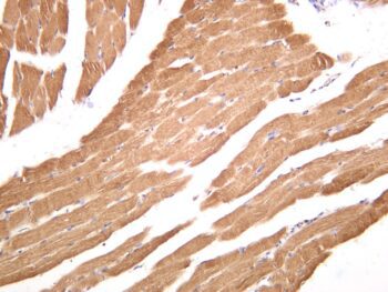 Lactate Dehydrogenase Rabbit Monoclonal Antibody - Image 2