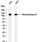 Hexokinase II Rabbit Monoclonal Antibody