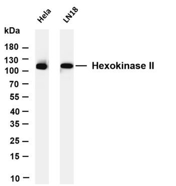 Hexokinase II Rabbit Monoclonal Antibody