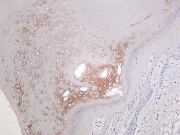 Hexokinase II Rabbit Monoclonal Antibody - Image 2