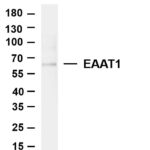 EAAT1 Rabbit Monoclonal Antibody