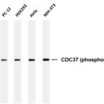 CDC37 (Phospho-Ser13) Rabbit Monoclonal Antibody