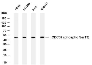CDC37 (Phospho-Ser13) Rabbit Monoclonal Antibody