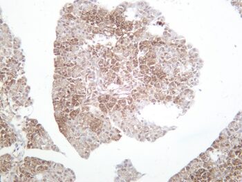 FABP4 Rabbit Monoclonal Antibody - Image 2