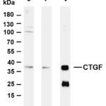 CTGF Rabbit Monoclonal Antibody