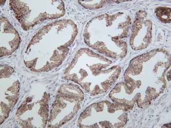 Hsp70 Rabbit Monoclonal Antibody - Image 2