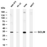 GCLM Rabbit Monoclonal Antibody