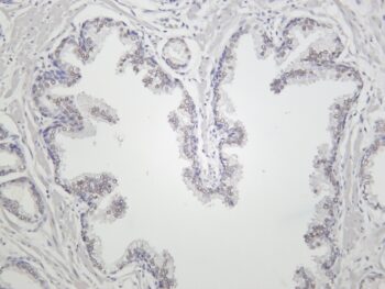 KDM1A Rabbit Monoclonal Antibody - Image 2
