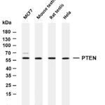 PTEN Rabbit Monoclonal Antibody